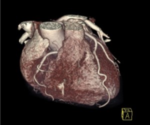 heart